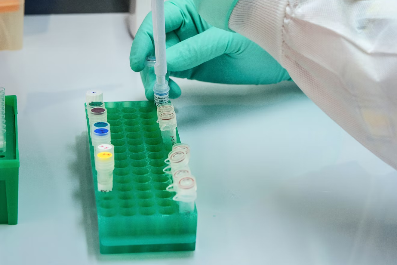 An image of lab samples in a tray.